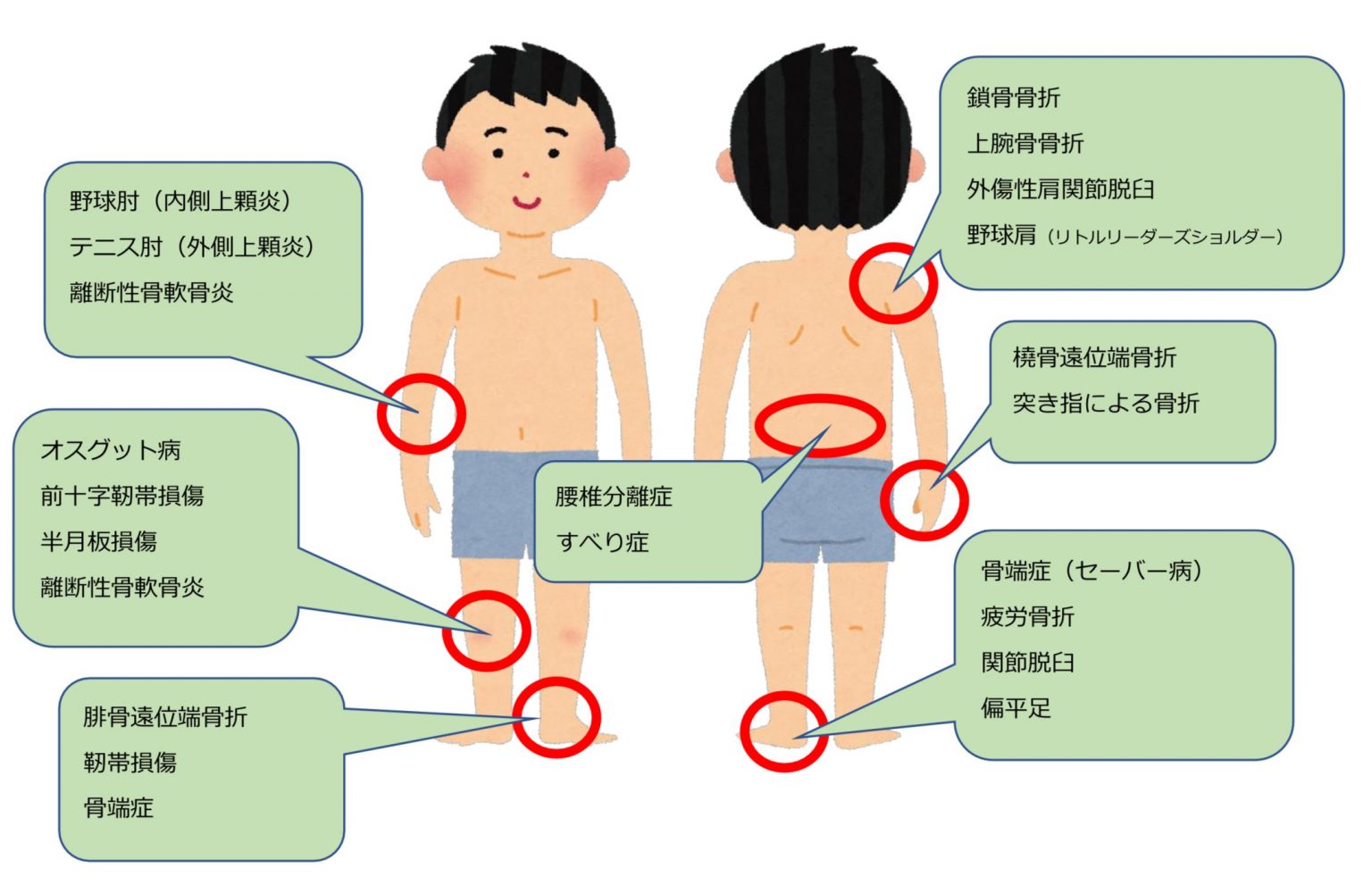 安価-運動器の傷害と機能障害 その病態とメカニズム / 沖田 実 編集